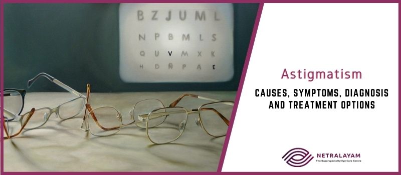 Astigmatism: Causes, Symptoms, Diagnosis and Treatment Options
