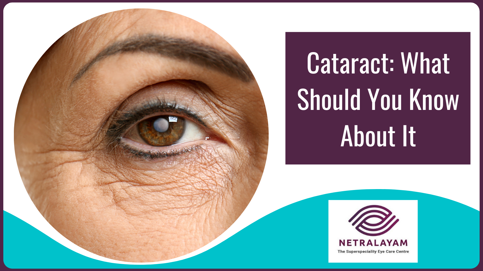 Cataract: What Should You Know About It