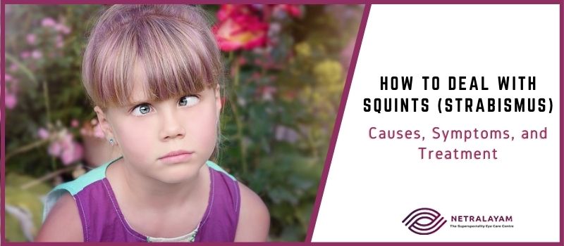 How to Deal with Squints (Strabismus): Causes, Symptoms, and Treatment