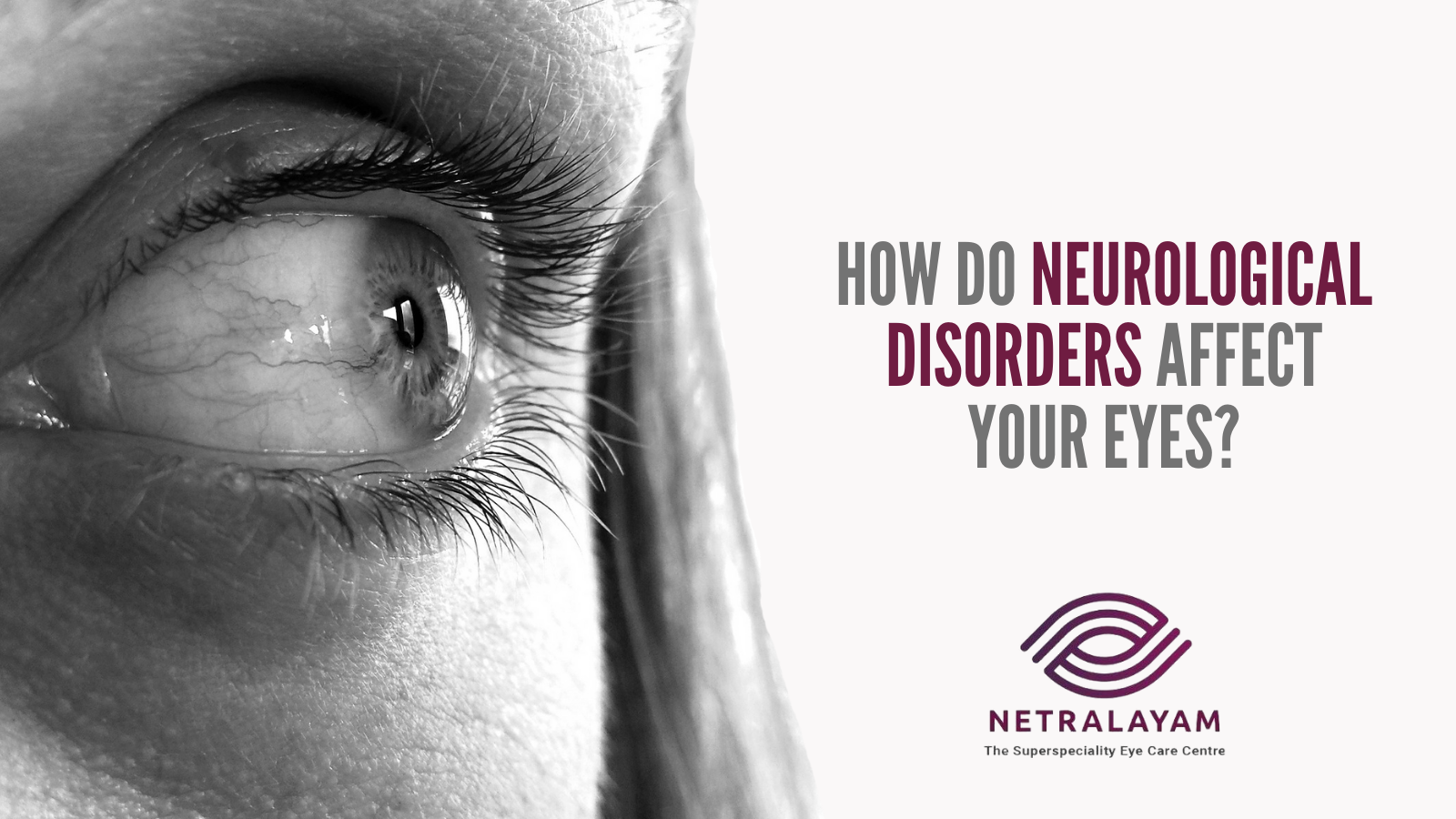 How do Neurological Disorders Affect Your Eyes?
