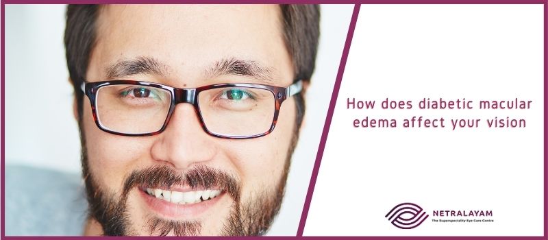 How does diabetic macular edema affect your vision