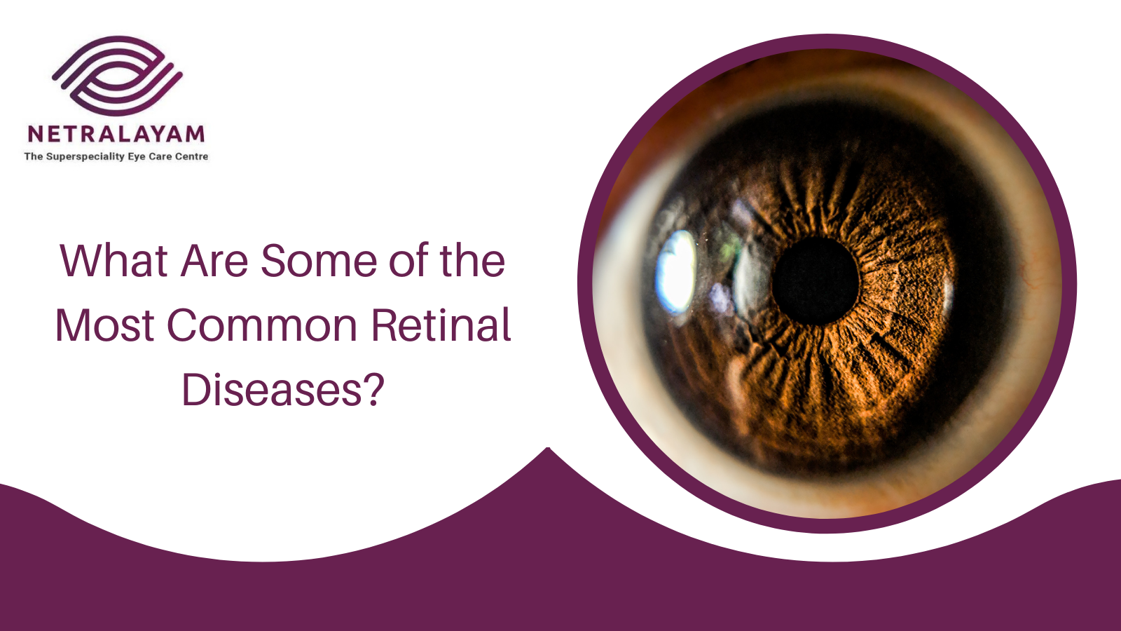 What Are Some of the Most Common Retinal Diseases?