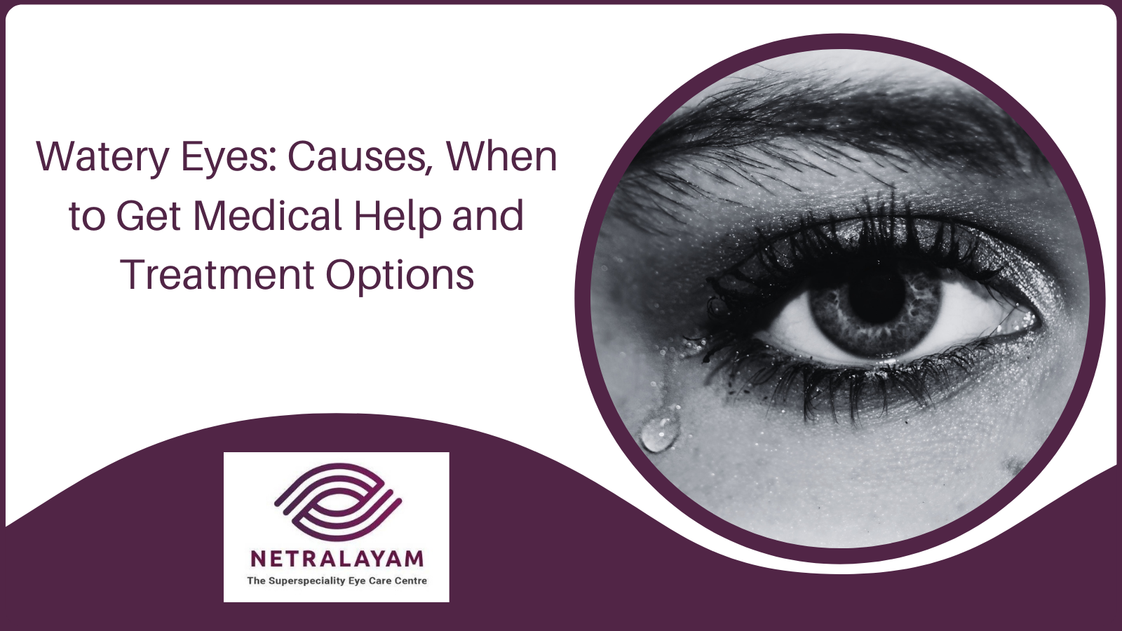 Watery Eyes: Causes, When to Get Medical Help and Treatment Options