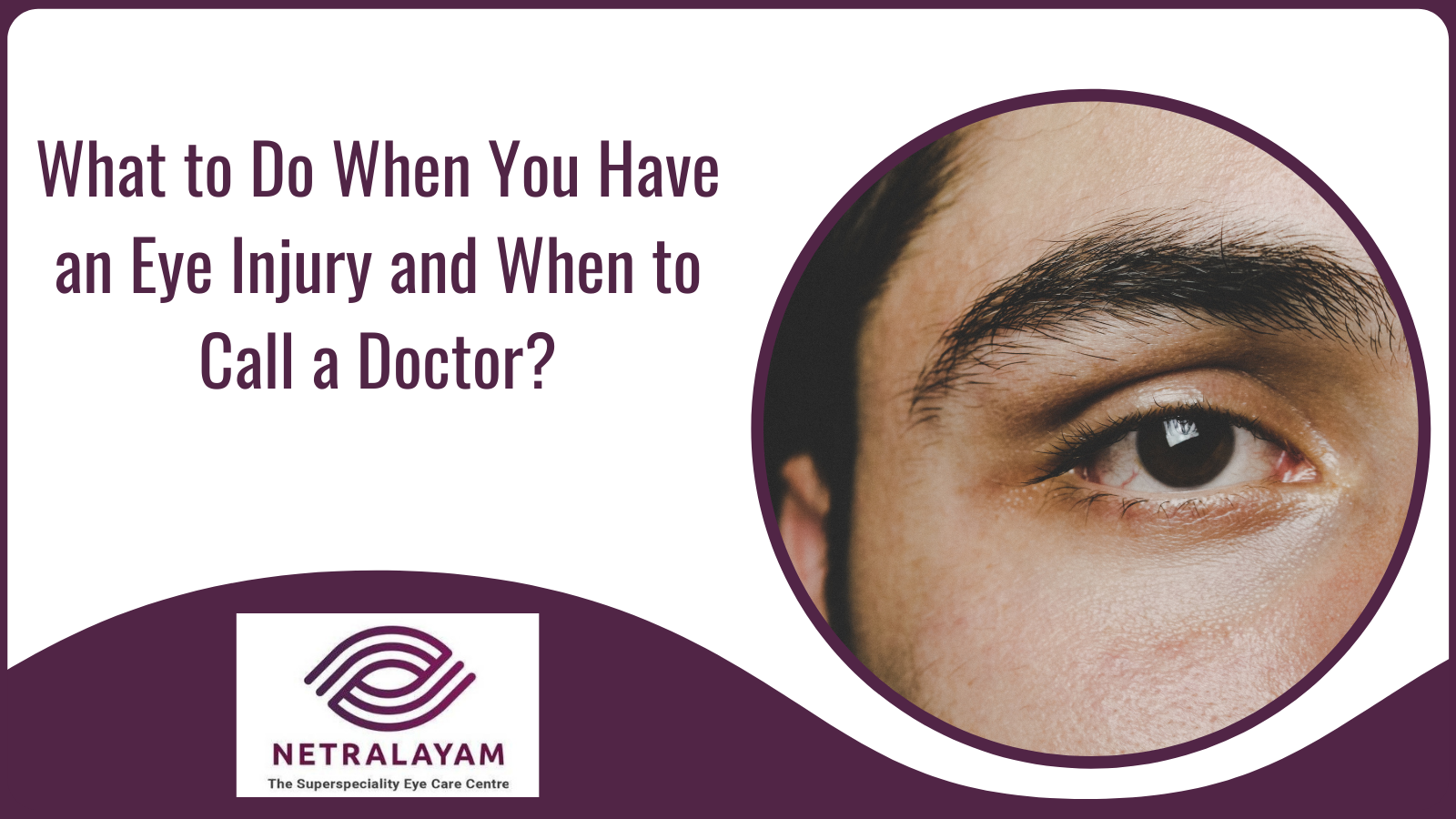 What to Do When You Have an Eye Injury and When to Call a Doctor?